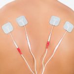 Close-up of a person's back with four adhesive electrode pads placed for electrical stimulation therapy. The pads are connected to wires, used to relieve muscle pain and tension. The background is plain and white, focusing attention on the treatment area.