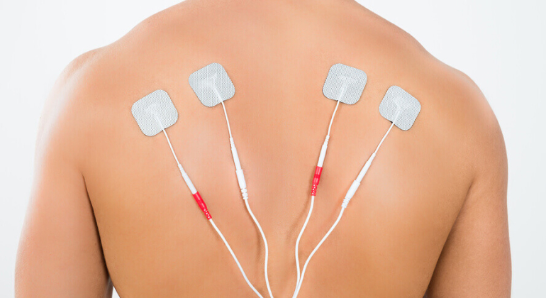 Close-up of a person's back with four adhesive electrode pads placed for electrical stimulation therapy. The pads are connected to wires, used to relieve muscle pain and tension. The background is plain and white, focusing attention on the treatment area.
