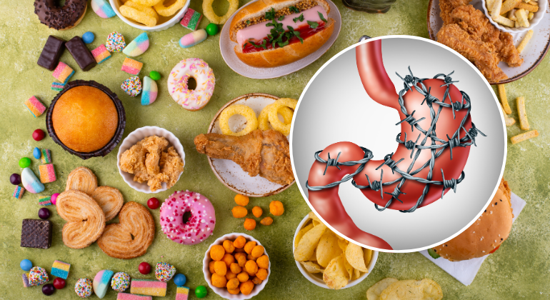 Assortment of unhealthy junk foods like fried chicken, sweets, chips, and burgers with an inset illustration of a stomach wrapped in barbed wire, symbolizing digestive issues or stomach pain caused by poor diet.