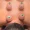 Cupping Therapy at Home A Natural Way to Heal Without Leaving Your Room