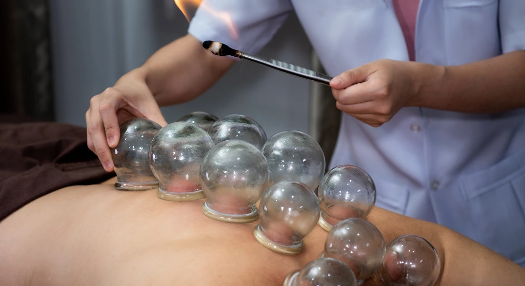 Why Try Cupping at Home