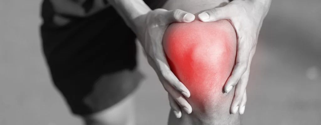 Chondromalacia Patella