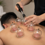 Cupping Therapy