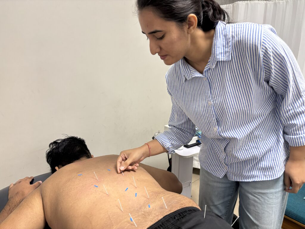 Dry Needling Therapy