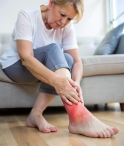 Ankle Pain Treatment