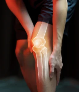 ACL Tear Treatment