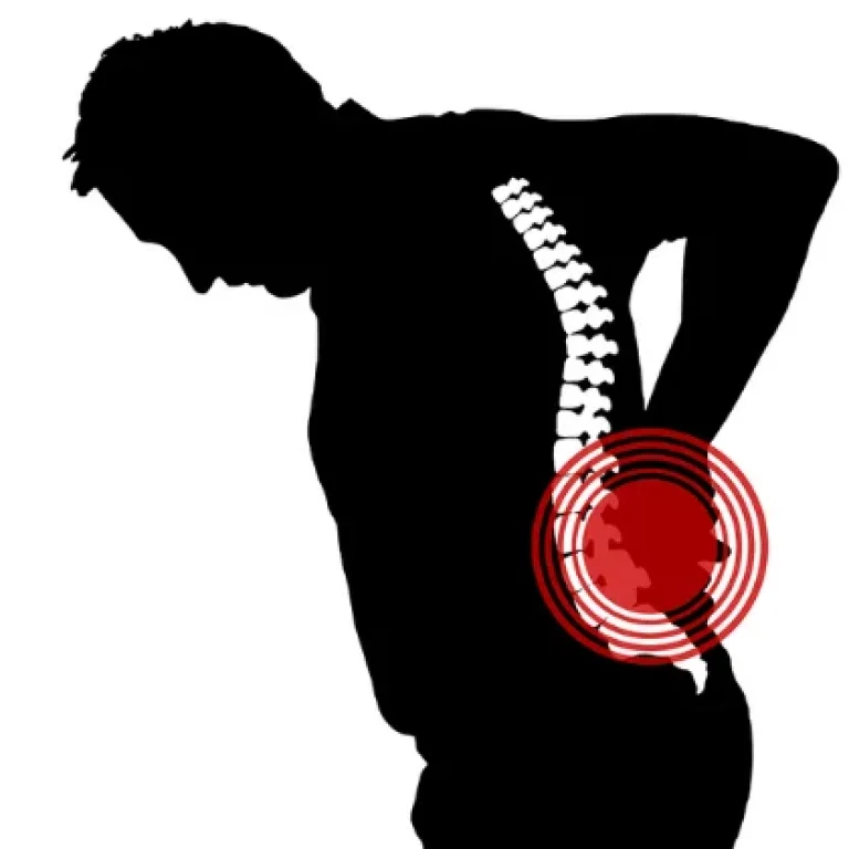 Home Physiotherapy for Sciatica