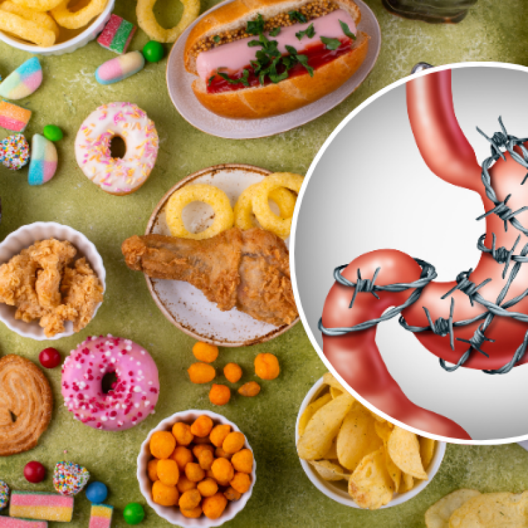 Assortment of unhealthy junk foods like fried chicken, sweets, chips, and burgers with an inset illustration of a stomach wrapped in barbed wire, symbolizing digestive issues or stomach pain caused by poor diet.